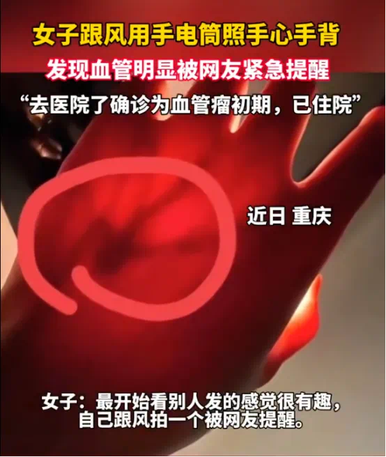 赢翻网配资 一张照片竟被网友看出血管瘤，身体出现这3个信号要当心